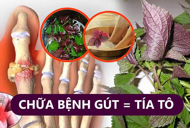 Cách chữa bệnh gout bằng lá tía tô