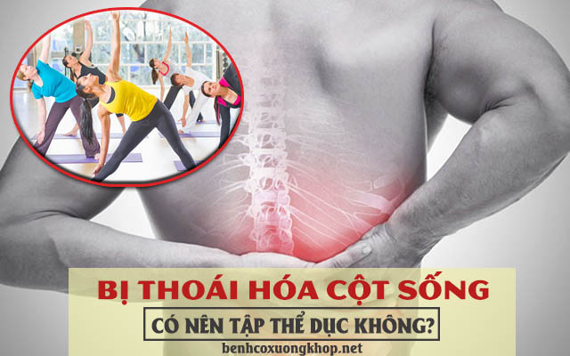 thoái hóa cột sống có nên tập thể dục