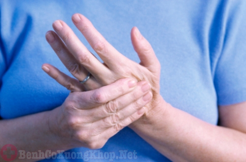 Phong tê thấp PV chữa bệnh tê nhức tay