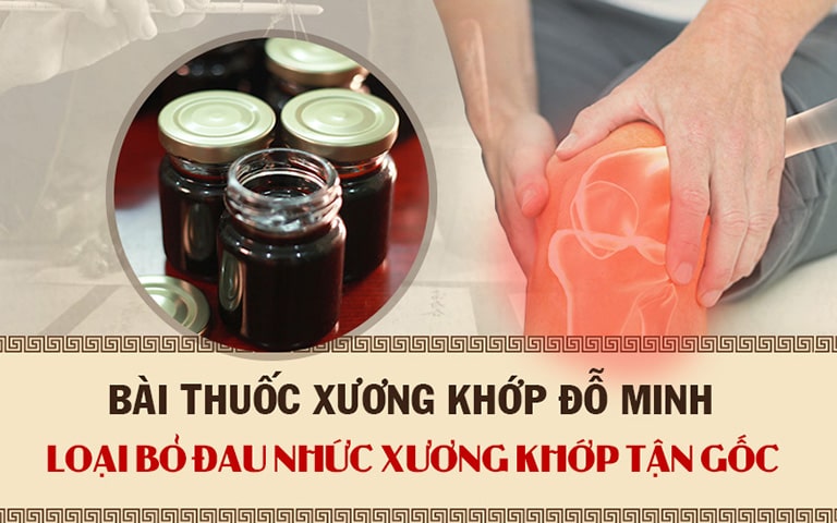 Xương khớp Đỗ Minh là giải pháp trị thoái hóa xương khớp được nhiều người bệnh lựa chọn