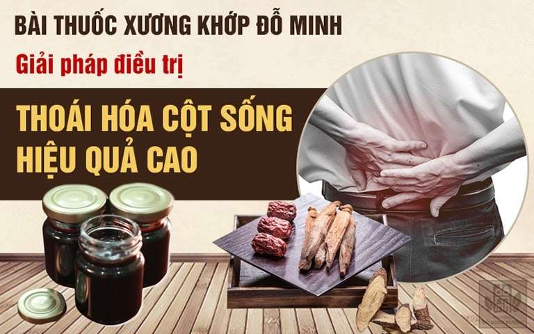 Xương khớp Đỗ Minh là giải pháp điều trị thoái hóa cột sống hiệu quả, được đánh giá cao